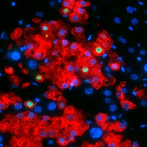 Scientists transform skin cells into functioning liver cells
