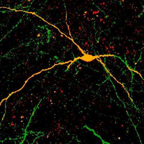 Human stem cell-derived neuron transplants reduce seizures in mice