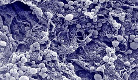 Immune cells get cancer-fighting boost from nanomaterials