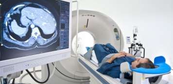 早期PET扫描阴性霍奇金淋巴瘤忽略RT的复发风险增加