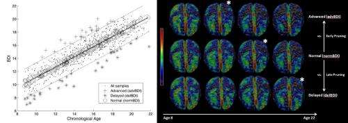 Index detects early signs of deviation from normal brain development