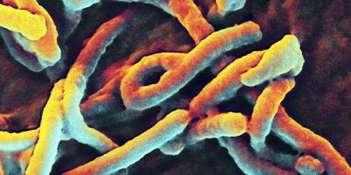 Infectious disease experts weigh in on the creation of a human vaccine to protect against Ebola