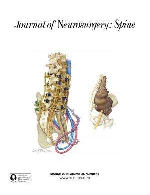 Innovative ‘False pedicle’ surgery allows for advanced spinal/pelvic reconstruction