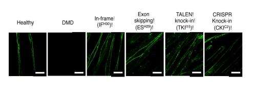 iPS cells used to correct genetic mutations that cause muscular dystrophy