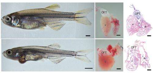 Zebrafish model helps identify compound that reverses a lethal form of cardiomyopathy