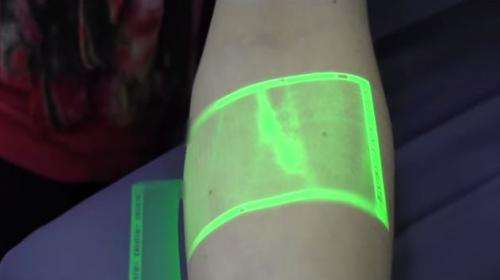Near-infrared technology plays role in visualizing veins