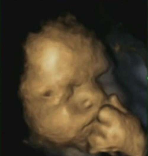 左撇子胎儿会显示产妇压力对未出生的孩子的影响