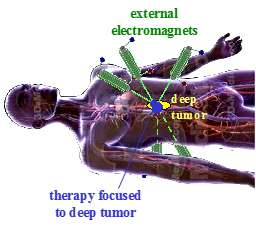 Magnetic drug delivery method could transform the way deep-tissue tumors and other diseases are treated