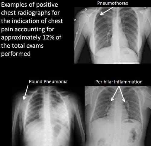 Many chest X-rays in children are unnecessary