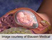 Maternal insulin sensitivity linked to fetal brain activity