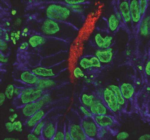 Scientists generate first human stomach tissue in lab with stem cells