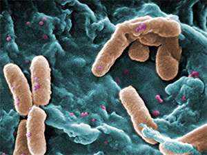 Microbiology: Pushing back against drug-resistant bugs