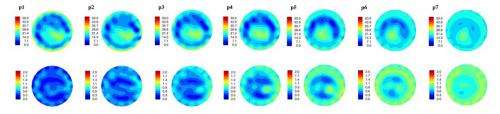 Microwave imaging of the breast