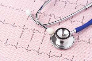 Minorities face disparities in treatment and outcomes of atrial fibrillation