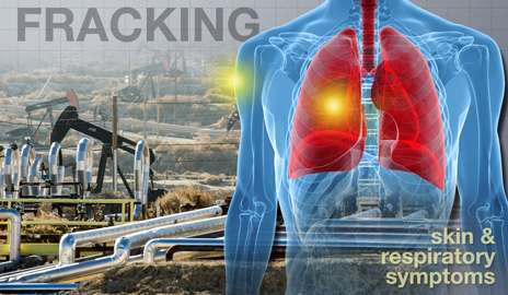 More health symptoms reported near ‘fracking’ natural gas extraction
