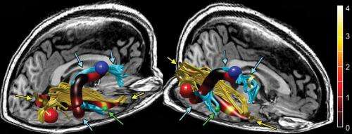 MRI identifies brain abnormalities in chronic fatigue syndrome patients
