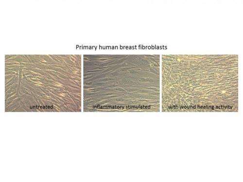 New analysis methodology may revolutionize breast cancer therapy