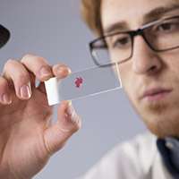 New blood test may help diagnose depression