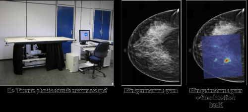 New breast cancer imaging method promising