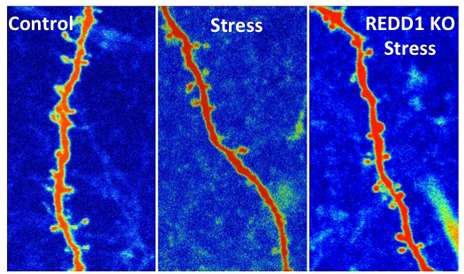 New finding suggests a way to block stress’ damage