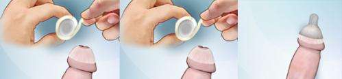 New Galactic Cap condom prevents pregnancy but not STDs