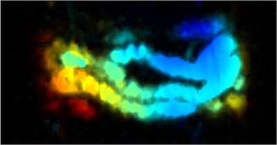 New imaging agent provides better picture of the gut