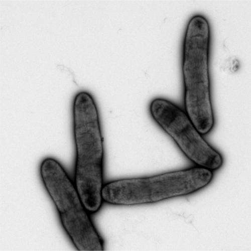 New membrane-synthesis pathways in bacteria discovered
