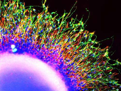 New stem cell research points to early indicators of schizophrenia