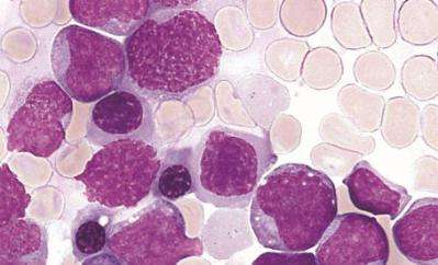 New test predicts survival in blood cancer patients