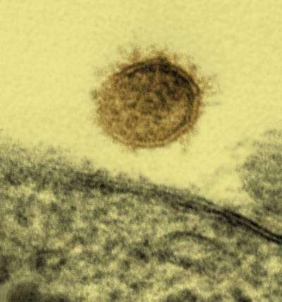 NIH scientists establish monkey model of hantavirus disease