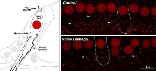 Noise-induced 'hidden hearing loss' mechanism discovered