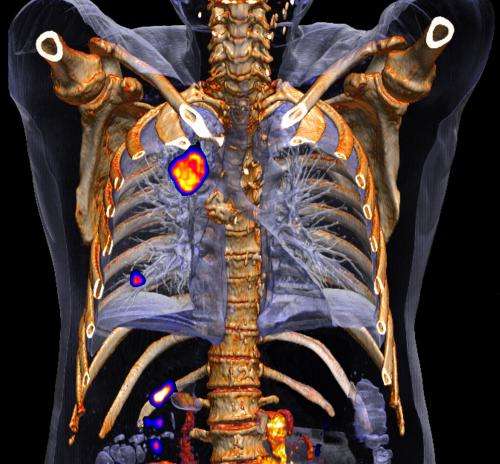 Non-stop PET/CT scan provides accurate images
