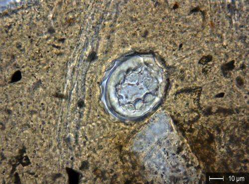 Parasite eggs from the Celtic period found in Switzerland