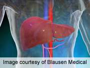 Patient factors affect accuracy of AFP detection of liver cancer