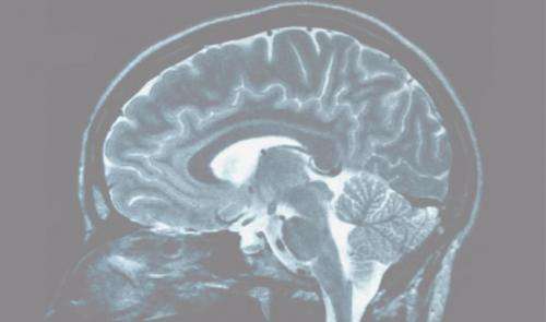 Positive, negative thinkers' brains revealed
