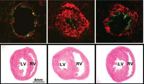 Protein in 'good cholesterol' may be a key to treating pulmonary hypertension