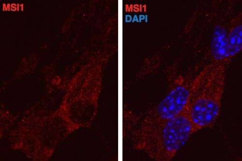 Proteins drive cancer cells to change states