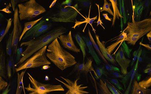 Protein switch dictates cellular fate: stem cell or neuron