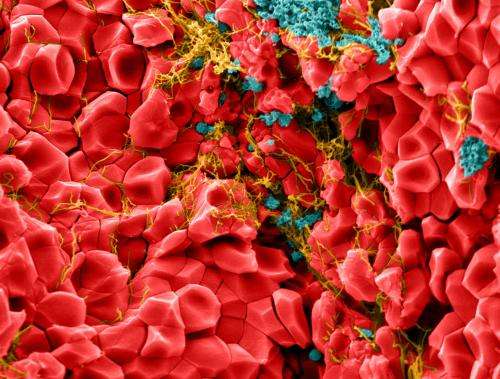 Red blood cells take on many-sided shape during clotting