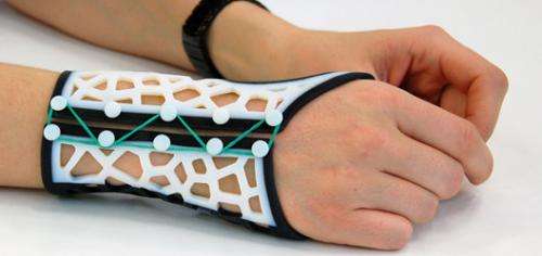 Research on 3-D printed wrist splints boost for arthritis sufferers