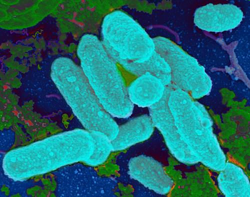 Scientist finds link between antibiotics, bacterial biofilms and chronic infections