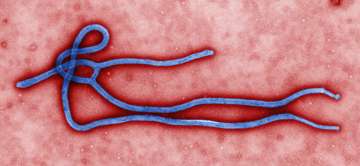 Seven things to know about Ebola