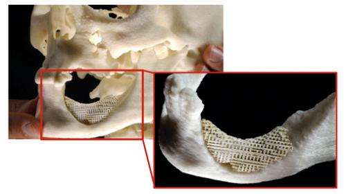 Shaped scaffolding helps repair mandibular bone