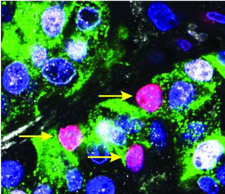 Silencing inhibitor of cell replication spurs beta cells to reproduce