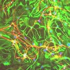 Single-Neuron “Hub” Orchestrates Activity of an Entire Brain Circuit