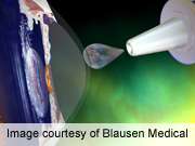 Sizable proportion of patients nonadherent to glaucoma meds