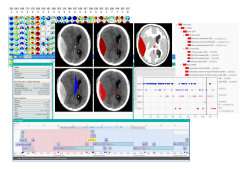 Smart treatment predictions for brain trauma