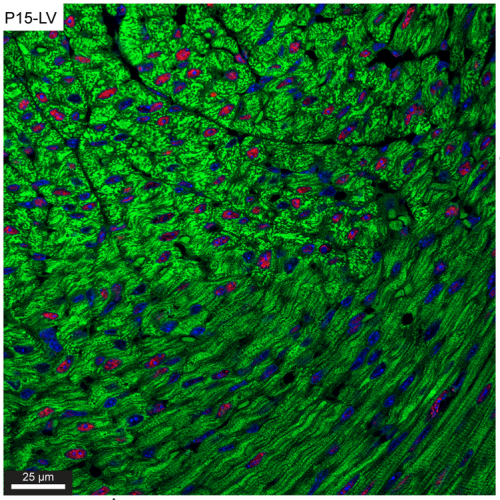 Spurt of heart muscle cell division seen in mice well after birth