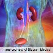 Statins may reduce risk of progression of renal cancer