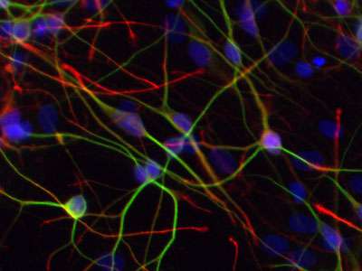 Stem cells reveal how illness-linked genetic variation affects neurons